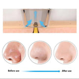 Electric Blackhead Remover – Deep Pore Vacuum Cleaner for Acne, Oil & Dead Skin